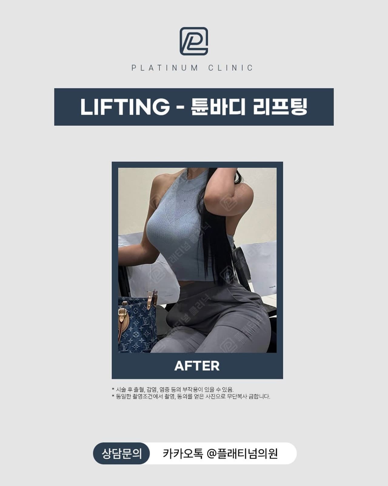 チューンボディ体型管理前後