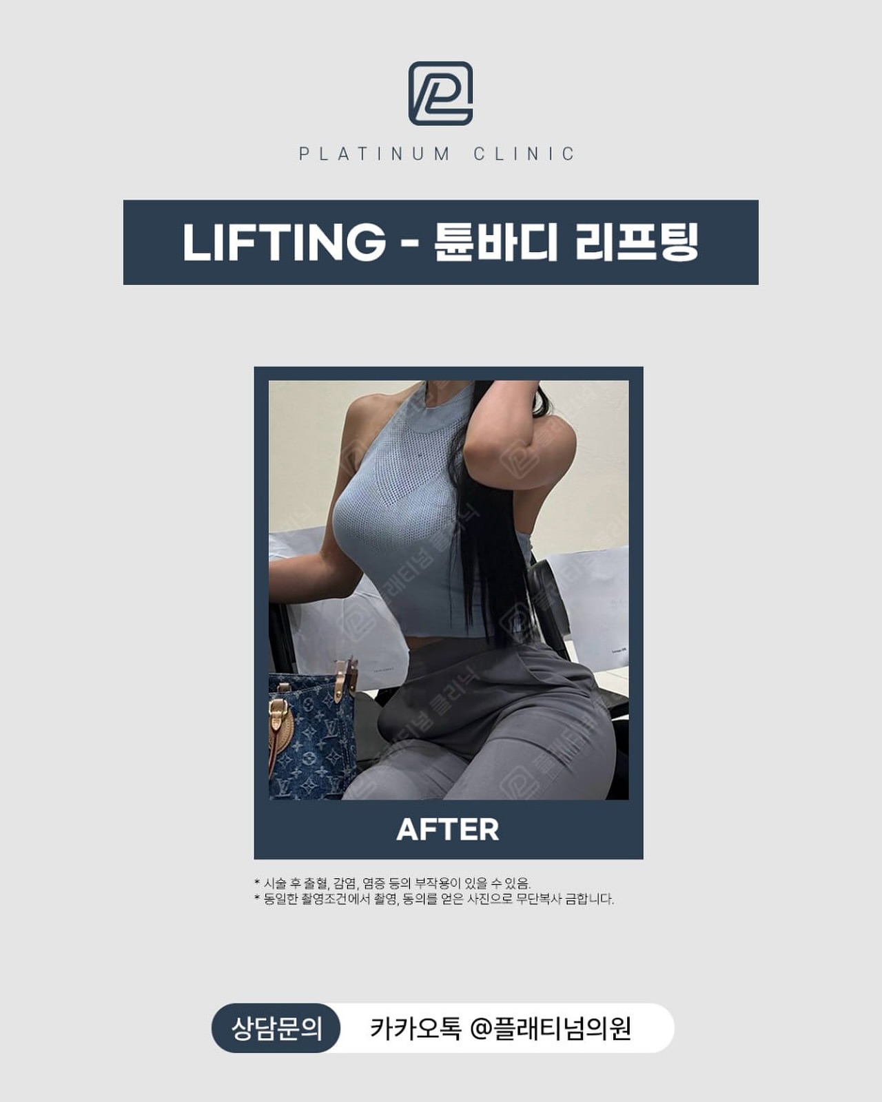 Tune Body 體型管理前後