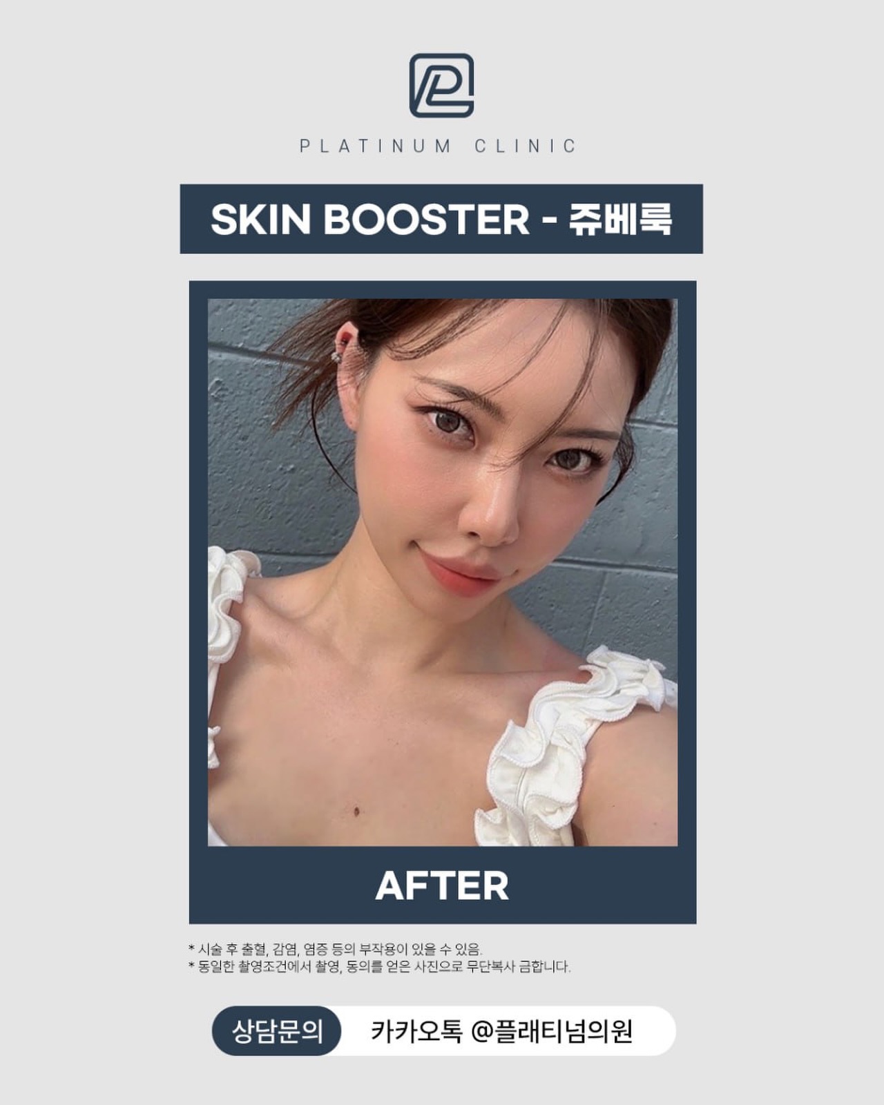 肌膚纹理改善 Juvelook體驗