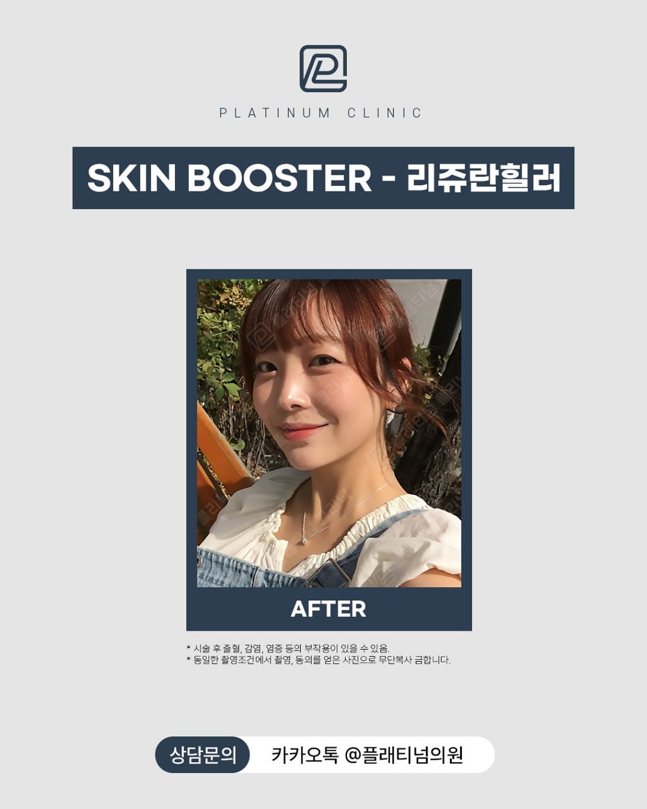 水光針真實测評