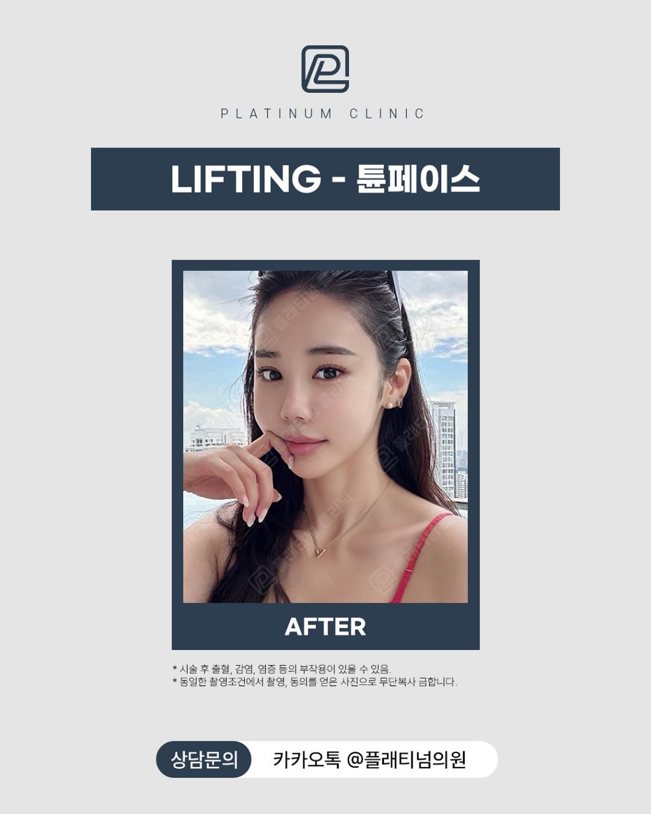 Tune Face前後對比