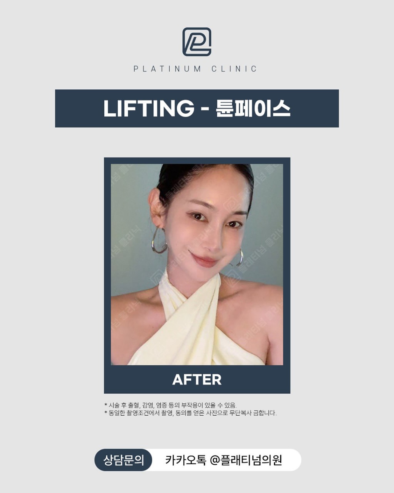 Tune Face提升前後對比